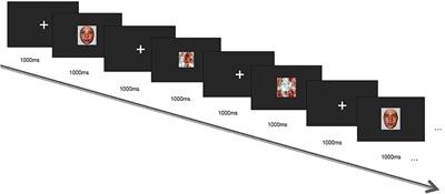 Face Recognition Brain Functional Connectivity in Patients With Major Depression: A Brain Source Localization Study by ERP